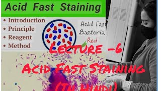 AFB Acid Fast Staining for MTuberculosis Bacillus staining medical viralvideoyoutube [upl. by Ashford]