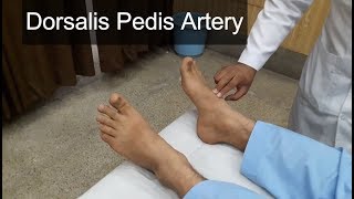 Dorsalis Pedis Artery Clinical Examination [upl. by Atikim475]