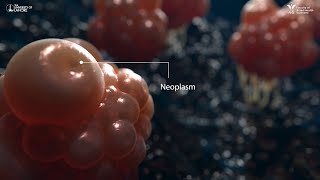 Neoplasm  3D Animation [upl. by Lorine816]