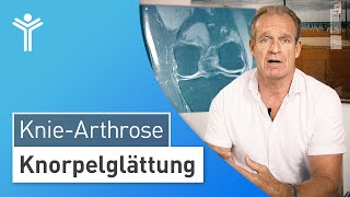 Knorpelschaden am Knie Wann macht die Knorpelglättung Sinn [upl. by Ixel754]