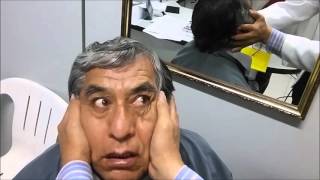 HEAD IMPULSE TEST Dr Justiniano Zea LimaPerú [upl. by Farnsworth]