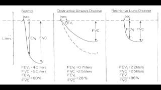 Obstructive vs Restrictive Lung Disease [upl. by Anilem]