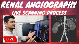 CT RENAL ANGIOGRAPHY LIVE SCAN  Live ct scan of renalabdominal Angiography radiologytechnologist [upl. by Assirem]