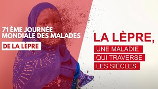 71ème journée mondiale des malades de la lèpre [upl. by Kristin]