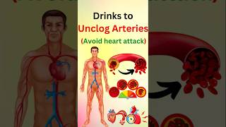 Drinks That CLEAR Your Arteries FAST [upl. by Femi468]