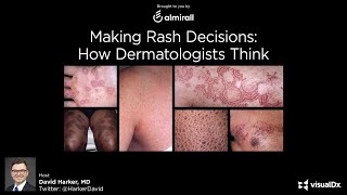 Making Rash Decisions How Dermatologists Think  Dr David Harker [upl. by Iad]