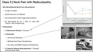 Neck Pain with Cervical Radiculopathy  Presentation  Treatment [upl. by Liagabba48]