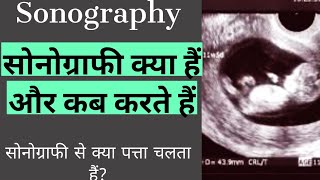 Sonography or ultrasound in hindi  by dr pravin munde [upl. by Anelah]