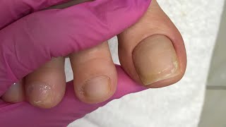 Live  Cutilagem e esmaltação dos pés 👣 [upl. by Adnalahs]