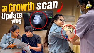 నా Growth Scan Update Vlog  Yadammaraju  StellaRaj 777 [upl. by Lledrev415]