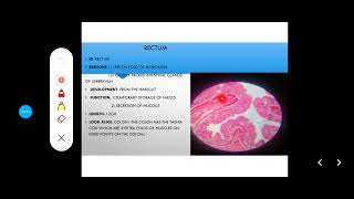 Histology Slides Series Episode 11  Histology of the Large Intestine Colon Appendix Rectum [upl. by Ethelbert]