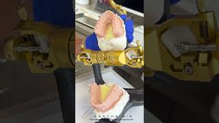 Patient example tmj case with years of suffering jaw pain gone in minutes tmjtreatment dentist [upl. by Anomahs]