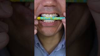 Nobel Super Soda Candy ASMR satisfying food candy shorts [upl. by Huey]