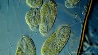 Various Ciliated Protozoa Kingdom Protista DIC Lighting Technique [upl. by Enilav]