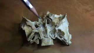 Sphenoid Bangla Demo [upl. by Aliban]