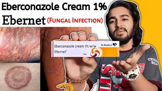 Ebernet Cream Review  Eberconazole Cream 1 For Ringworm Itching Fungal Infection [upl. by Ferrick251]