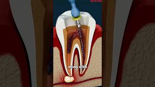 What Is A Root Canal 😳facts shorts youtubeshortsshortsvideo reels [upl. by Ardnac]