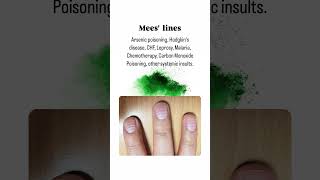 Common Nail Diseases You Should Know About NailHealthNailCareFungalInfectionNailPsoriasis [upl. by Kosel]