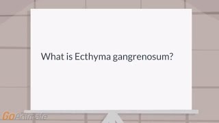 What is Ecthyma gangrenosum [upl. by Ij]