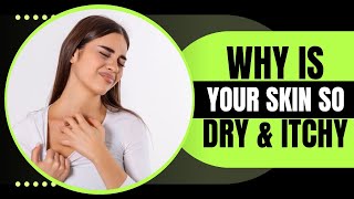 10 Reasons Behind Your Dry Itchy Skin – And How to Prevent It [upl. by Buiron]