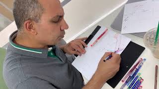 1 Nerves of lower limb [upl. by Bazar]