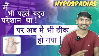 Successful Hypospadias Surgeon in Kolkata  मूत्र का छिद्र सही जगह पर न खुलने की समस्या  Dr Nagwani [upl. by Anahpos]