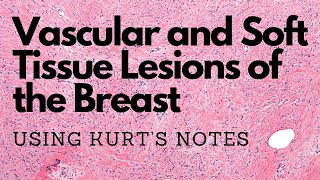 Vascular and Soft Tissue Lesions of the Breast Kurts Notes pathagonia [upl. by Naara]