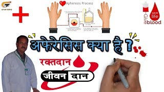 Apheresis अफेरेसिस क्या है  By Gyan Fundo [upl. by Ayarahs100]