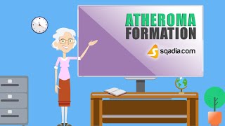 Atheroma Formation  Pathology Animation Video  Medical Online Education  VLearning™ [upl. by Eiggam240]