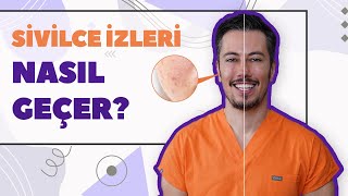 Sivilce İzleri Nasıl Geçer Akne İzleri Tedavisi [upl. by Meletius210]