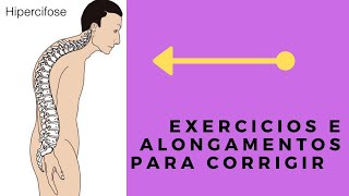 EXERCÍCIOS E ALONGAMENTOS PARA CORRIGIR A CIFOSE TORÁCICA [upl. by Luba]