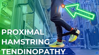 How I BEAT Proximal Hamstring Tendinopathy Runners Story [upl. by Frederica]