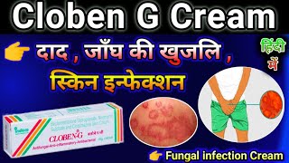 Cloben G Cream Uses in Hindi  Cloben cream use for Fungal infection  Skin disease Cream [upl. by Owiat]