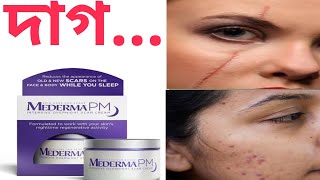 Mederma PM Intensive Overnight Scar Cream  Medrma Pm Night Cream Mederma pm cream bangla [upl. by Ahteres]