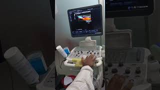 Mindray  DCN3 Pro Ultrasound Machine Linear Probe [upl. by Lemahs]