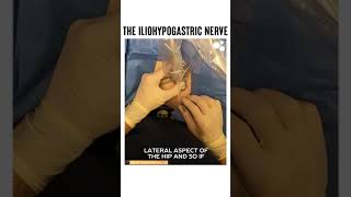 The Iliohypogastric Nerve [upl. by Gerson101]