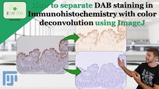 How to separate DAB staining in a IHC with color Deconvolution using ImageJ DAB IHC imagej [upl. by Davidson535]