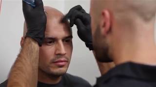 Chris Life Changing Transformation with Scalp Micropigmentation  Scalp Micro USA [upl. by Lubow]