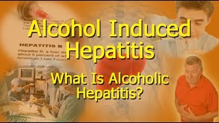 Alcohol Induced Hepatitis  What Is Alcoholic Hepatitis [upl. by Woodson]