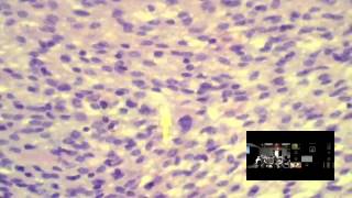 DERMPATH LIVE  March 2016  Jerad M Gardner MD [upl. by Oigile]