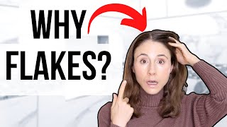 Why Your Scalp Is Flaky The Difference Between Dryness And Dandruff Explained [upl. by Abram]