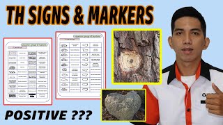 TREASURE HUNTING SIGNS AND MARKERS YOU SHOULD KNOW  VOURVON RONIEL [upl. by Nesline]