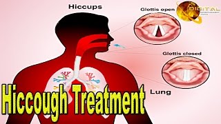 Hiccough Treatment  Health Tips  HD Video [upl. by Leizahaj]