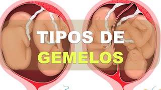 ¿Qué tipos de Gemelos hay Explicación fisiológica [upl. by Zetniuq]