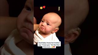 Deaf baby hears for the first time🥺♥️ shorts [upl. by Enair542]