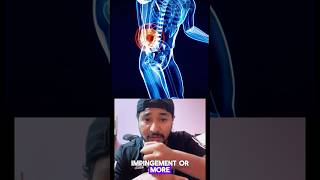 Trendelenburg gait how it’s cause  glutes medius weakness neurological hip pathology shortvideo [upl. by Tracy]