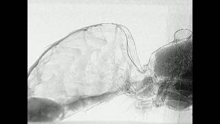 Folded Intersegmental Membrane FIM in a Honey Bee Abdomen [upl. by Sylvie]