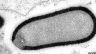 Virus Resurrected After Being Frozen For 30000 Yrs  Pithovirus Sibericum [upl. by Gibbon]