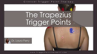 The Trapezius Trigger Points [upl. by Kei]