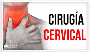 ▷ Cirugía de columna mínimamente invasiva  Remplazo del Disco Cervical  Biziondo [upl. by Lovering]